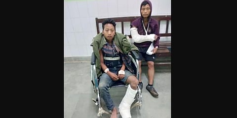 The victims – Nokphua Wangpan and Ramwang Wangsu – escaped with injuries (Photo | Special arrangement)