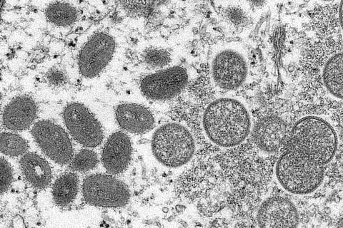 This 2003 electron microscope image made available by the Centers for Disease Control and Prevention shows mature, oval-shaped monkeypox virions. (Photo | AP)