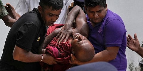 An injured Sri Lankan Buddhist monk injured after attacked by government supporters. (Photo | AP)