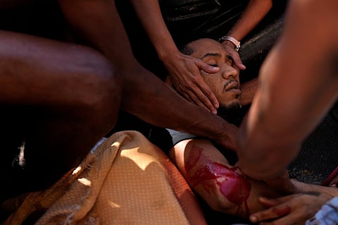 A resident comforts a wounded man after a police operation that resulted in multiple deaths, in the Complexo do Alemao favela in Rio de Janeiro, Brazil, on July 21, 2022. (Photo | AP)