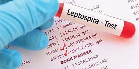 For representational purposes