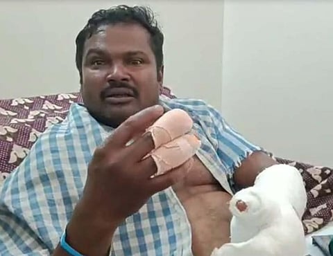 Denied sedative drugs, gang attacks pharmacist in Coimbatore