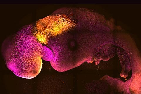 This microscope image provided by researchers Gianluca Amadei and Charlotte Handford in August 2022 shows a synthetic mouse embryo with colors added to show brain and heart formation. (Photo | AP)