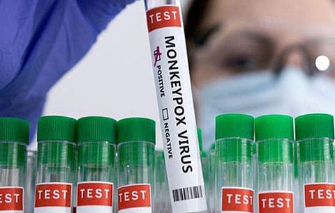 There is no information about the patient's travelling abroad recently. (Photo | ANI)