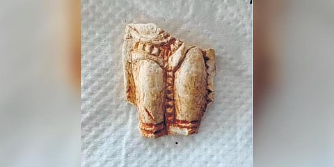 The broken figurine shows the hip and the thigh of a human form | Express