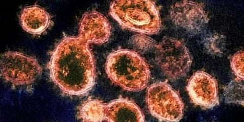 For representational purposes (File photo | AP)