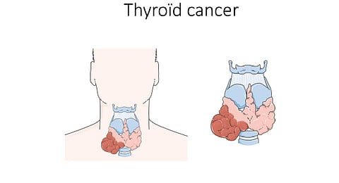 Image used for representational purposes only (Photo | Wikimedia Commons)