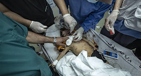 A Palestinian child wounded in the Israeli bombardment of the Gaza Strip is treated in a hospital in Khan Younis. (Photo | AP)