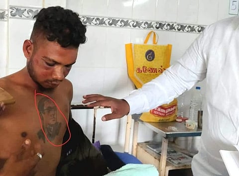 Saravanan was assaulted severely after they noticed the tattoo on his chest.