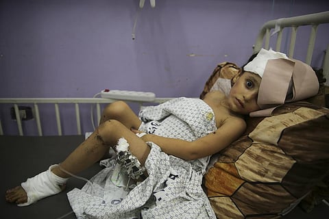 Kenzi al Madhoun, a four-year-old who was wounded in Israeli bombardment, lies at Al Aqsa Hospital in Deir al Balah City, Gaza Strip. (Photo | AP)