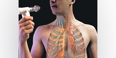 For representational purposes