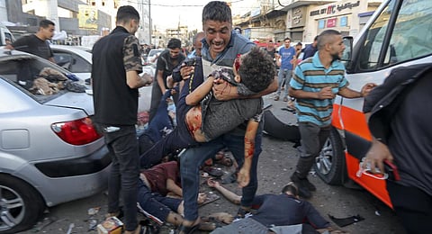 A man steps over the bodies of dead and injured Palestinians lying on the ground following an Israeli airstrike outside the entrance of the al-Shifa hospital in Gaza City. (Photo | AP)