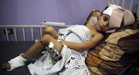 Kenzi al Madhoun, a four-year-old who was wounded in an Israeli bombardment, lies at Al Aqsa Hospital in Deir al Balah City, Gaza Strip.  (Photo | AP)