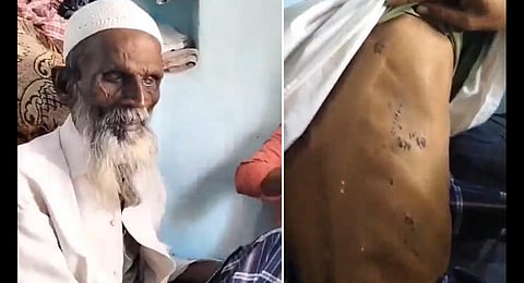 A 65-year-old Muslim man was tortured by an unidentified duo in Gangavati town of Koppal district (Videograb)