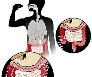 Image used for representational purposes