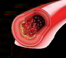 Good cholesterol—good for brain?