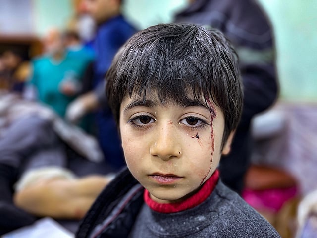 An injured child awaits treatment at the hospital following an earthquake, in the rebel-held northern countryside of Syria's Idlib province on the border with Turkey, early on February 6, 2023. (Photo | AFP)