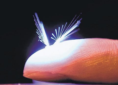 Image used for representational purpose only. (File Photo)