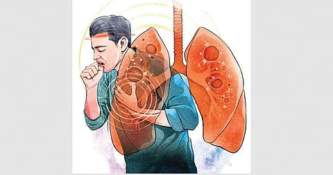 Image used for representational purposes only