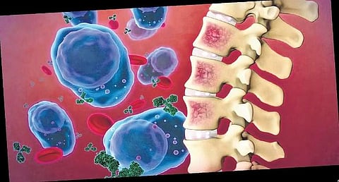 Image used for representative purposes only.