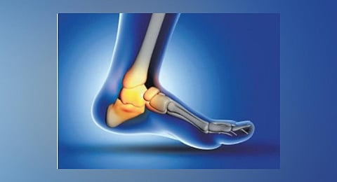 Image used for representative purposes only.