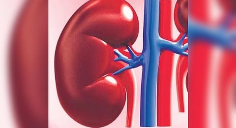 For representational purposes