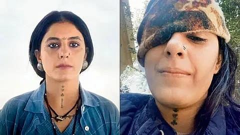 The Actor's injury as seen in the selfie. (Photo | instagram)