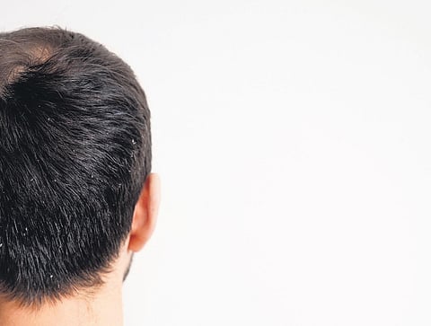 Image used for representational purpose only. (File Photo)