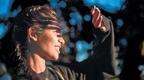 Representational image,The skin will become dehydrated on getting sunburnt