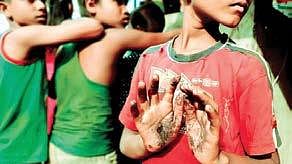 Representative Image.