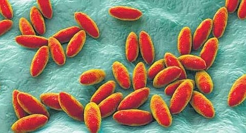 Image used for representational purpose.