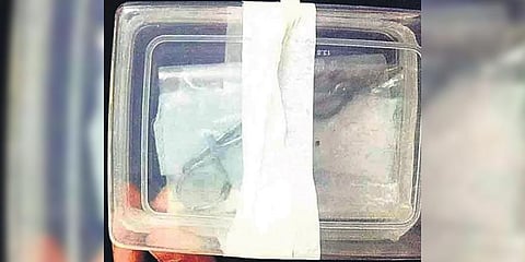 The pair of scissors found from Harshina’s stomach.