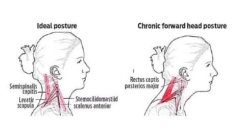 For representational purposes