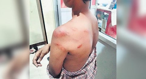 The teacher beat the student for fighting with another boy | Express