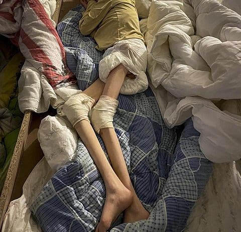 In this image released on July 27, 2023, by the Center of Legal Resources, a malnourished child lies on an improvised bed in the basement of a care home in Bardesti, Romania. (Photo | AP)