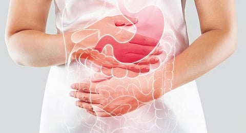 Irritable bowel syndrome: Motion derailed