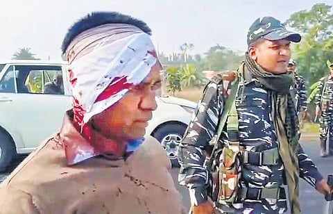 A seriously injured ED official after the attack.