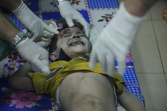 Palestinian child wounded in Israeli bombardment is treated in a hospital in Deir al-Balah, south of the Gaza Strip | AP