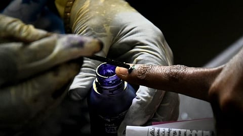 Image used for representational purposes.