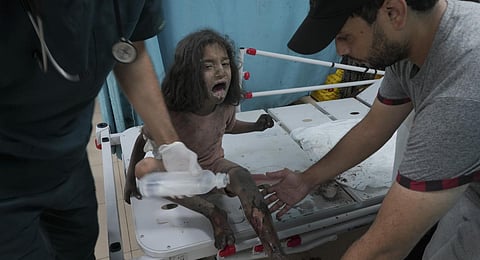 A Palestinian child wounded in an Israeli bombardment is treated in a hospital in Deir al Balah, south of the Gaza Strip. (Photo | AP)