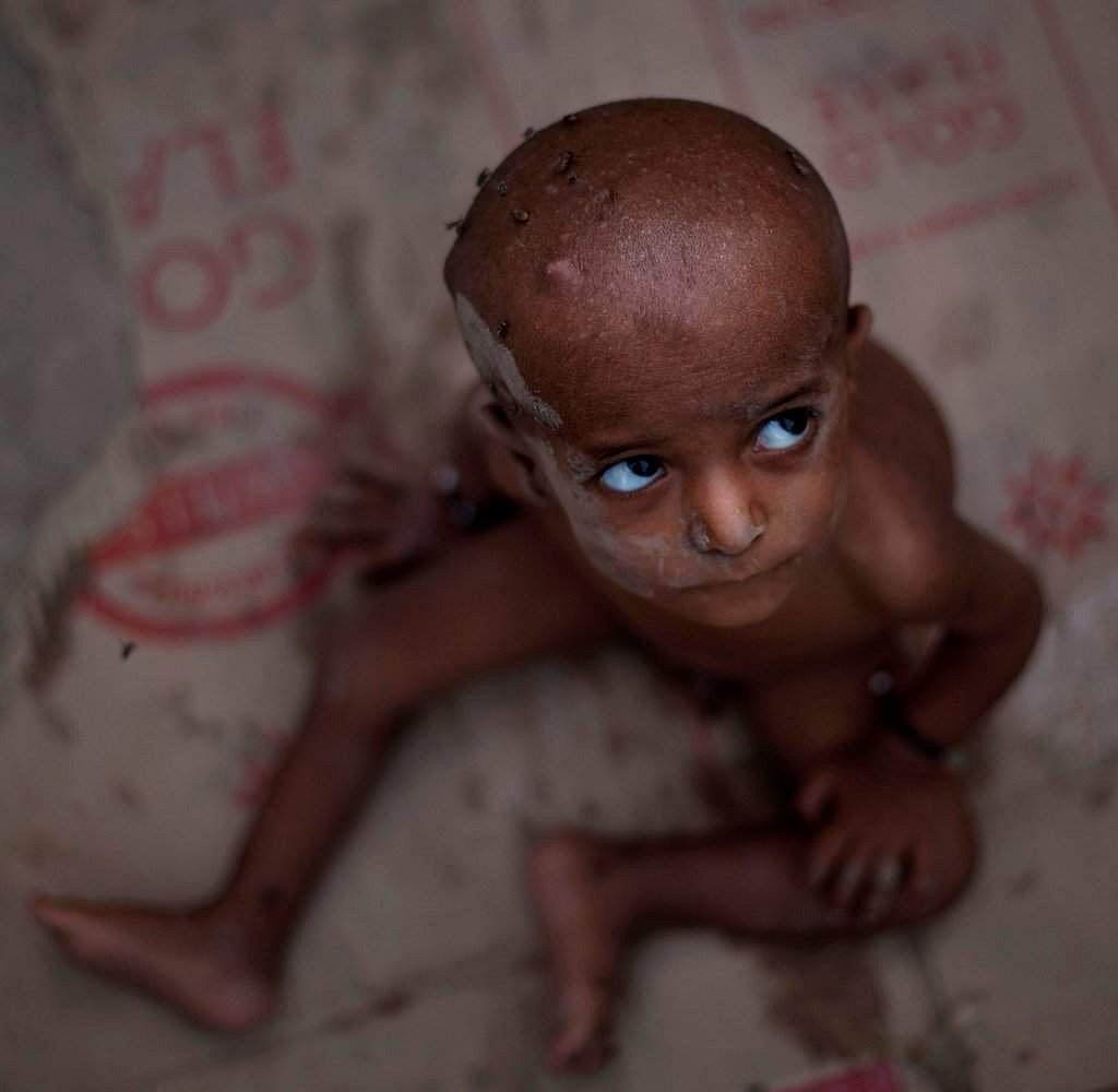India's hunger problem worse than North Korea, Myanmar: Report