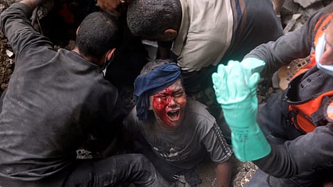 An injured Palestinian boy cries as rescuers try to pull him from the rubble of a destroyed building following an Israeli airstrike in Bureij refugee camp, Gaza Strip.