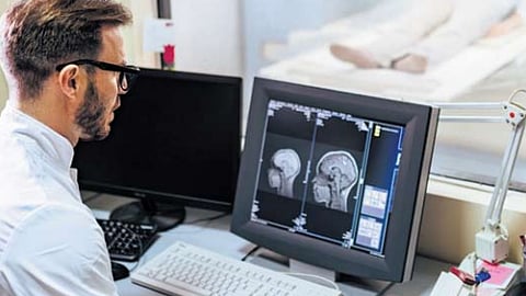 Representative Image