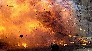 Image used for representational purposes.