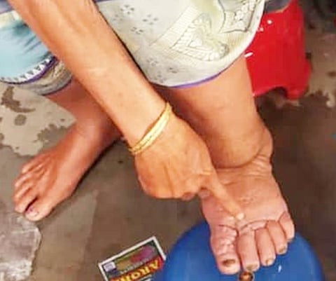 Image used for representation.