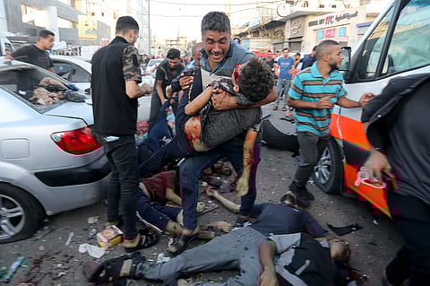 Dead and injured Palestinians are seen on the ground following an Israeli airstrike outside the entrance of the al-Shifa hospital in Gaza City.