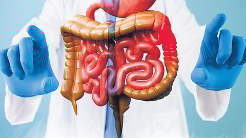 Incidence of colon cancer in youth on the rise