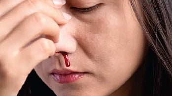 Image used for representational purposes only