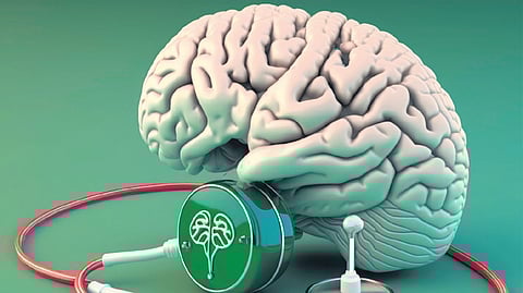 Representative Image