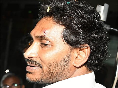Andhra CM Jagan Reddy injured in stone attack.